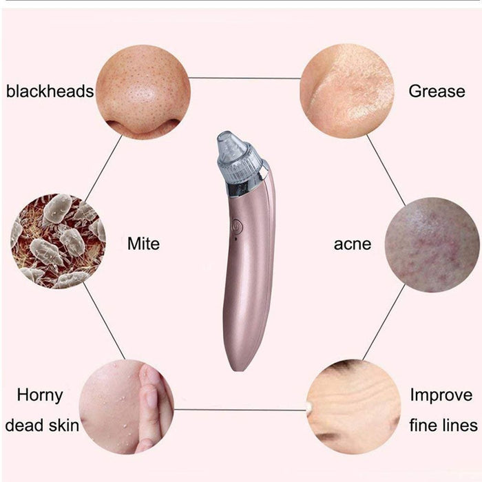 Aspirador eléctrico para impurezas de la piel